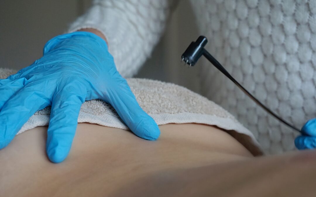 Baunscheidt Therapie